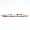 Braid Pink Gold Intreccio tra Lusso e Carattere